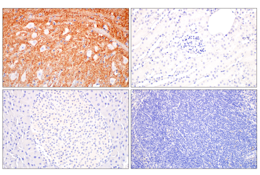 Immunohistochemistry Image 4: VGLUT2 (E2V4W) Rabbit mAb