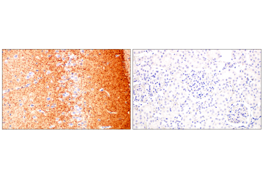 Immunohistochemistry Image 6: VGLUT2 (E2V4W) Rabbit mAb