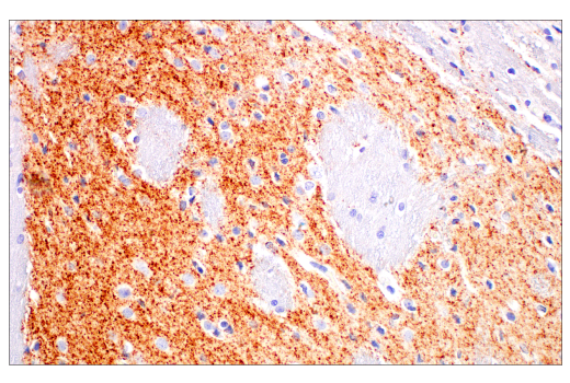 Immunohistochemistry Image 5: VGLUT2 (E2V4W) Rabbit mAb