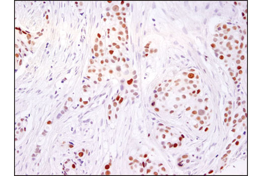 Immunohistochemistry Image 3: Ezh2 (D2C9) XP® Rabbit mAb (BSA and Azide Free)