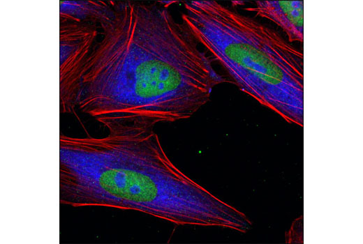 Immunofluorescence Image 2: Ezh2 (D2C9) XP® Rabbit mAb (BSA and Azide Free)
