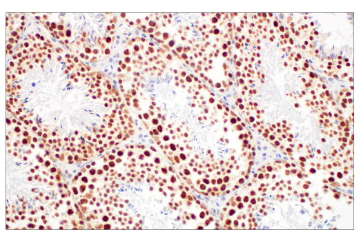 Immunohistochemistry Image 9: Ezh2 (D2C9) XP® Rabbit mAb (BSA and Azide Free)