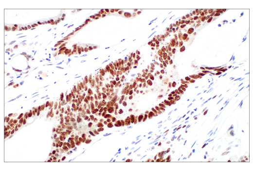 Immunohistochemistry Image 1: Ezh2 (D2C9) XP® Rabbit mAb (BSA and Azide Free)