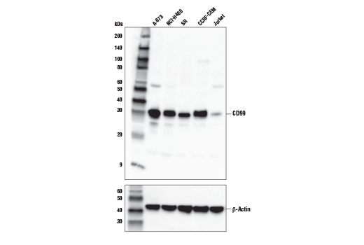 Western Blotting Image 1: CD99 Antibody