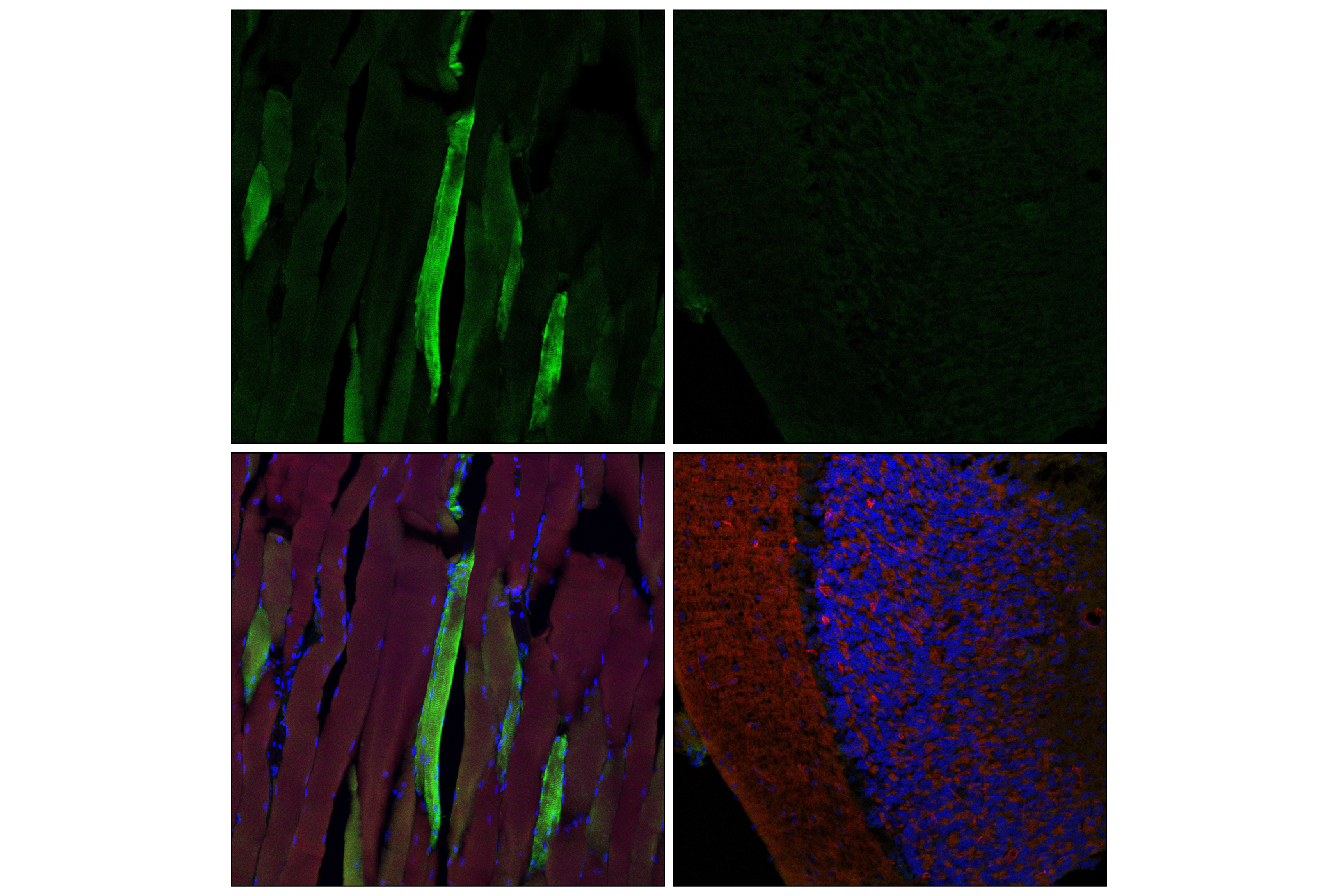 Immunofluorescence Image 1: HSP20 (E9Z1O) Rabbit mAb