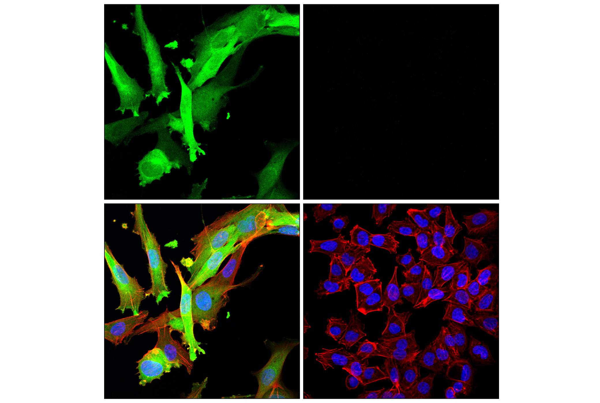 Immunofluorescence Image 2: HSP20 (E9Z1O) Rabbit mAb
