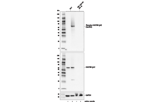  Image 6: p62/KEAP1/NRF2 Pathway Antibody Sampler Kit