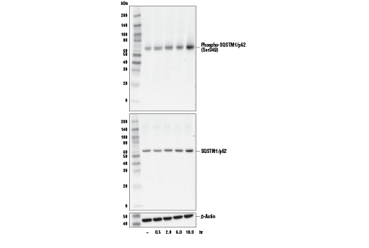  Image 15: p62/KEAP1/NRF2 Pathway Antibody Sampler Kit