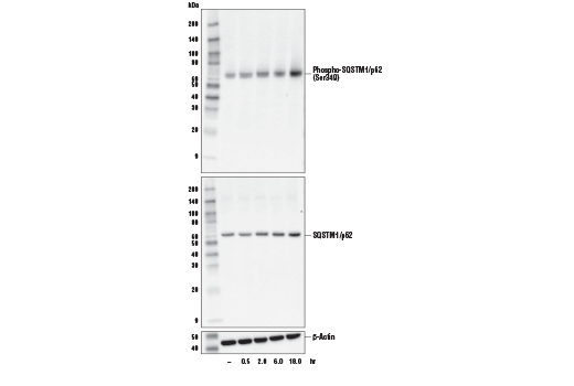 undefined Image 13: p62/KEAP1/NRF2 Pathway Antibody Sampler Kit