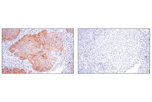  Image 34: p62/KEAP1/NRF2 Pathway Antibody Sampler Kit