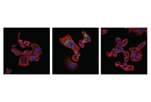  Image 35: p62/KEAP1/NRF2 Pathway Antibody Sampler Kit