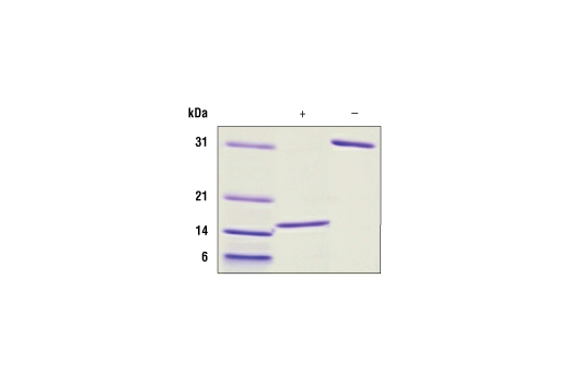  Image 2: Human GDNF Recombinant Protein
