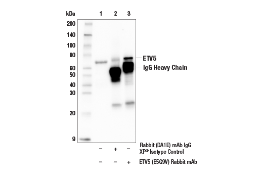 Immunoprecipitation Image 1: ETV5 (E5G9V) Rabbit mAb