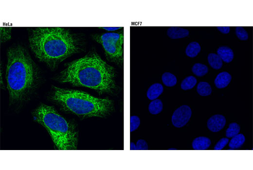 Immunofluorescence Image 1: Keratin 7 (D1E4) XP® Rabbit mAb (BSA and Azide Free)