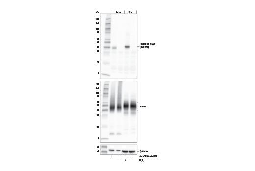Western Blotting Image 1: Phospho-CD28 (Tyr191) (E5B9Z) Rabbit mAb