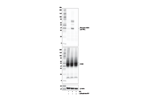 Western Blotting Image 2: Phospho-CD28 (Tyr191) (E5B9Z) Rabbit mAb