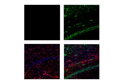Immunofluorescence Image 1: APP (E9M5J) Rabbit mAb