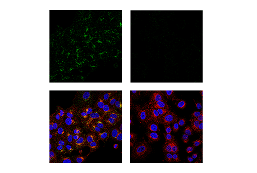 Immunofluorescence Image 3: APP (E9M5J) Rabbit mAb