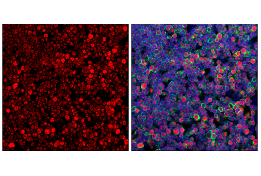 Immunofluorescence Image 2: TCF1/TCF7 (E6O1K) Rabbit mAb