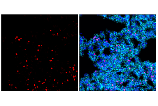 Immunofluorescence Image 3: TCF1/TCF7 (E6O1K) Rabbit mAb