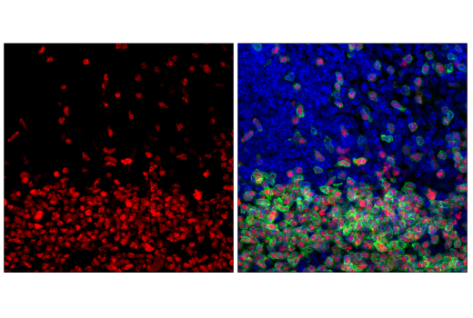Immunofluorescence Image 1: TCF1/TCF7 (E6O1K) Rabbit mAb