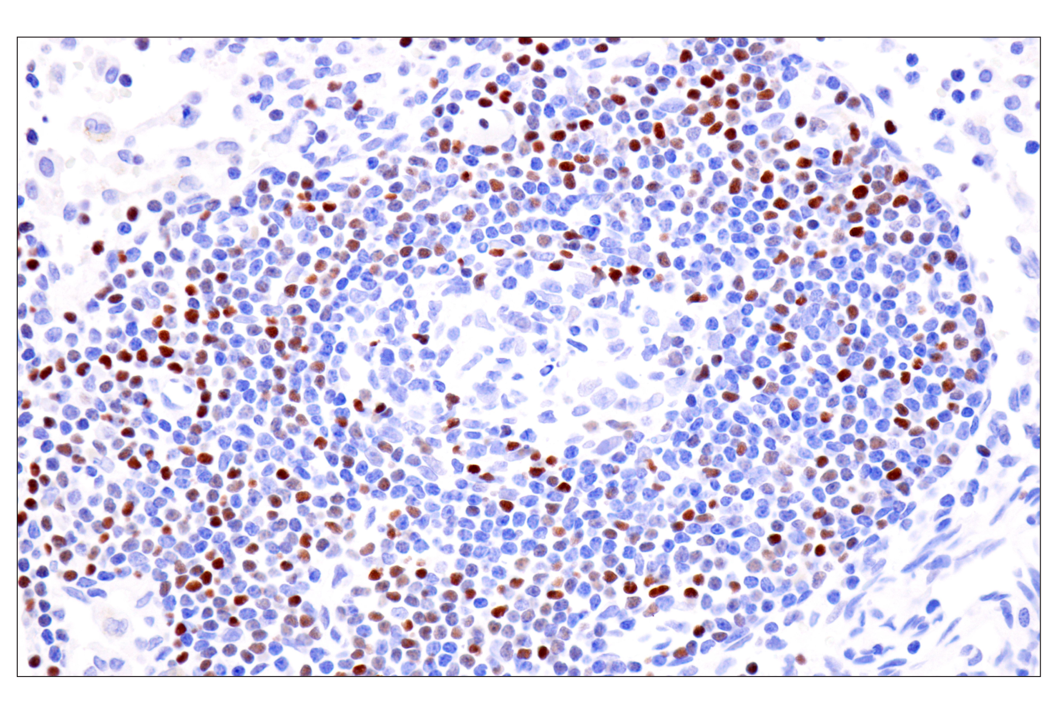Immunohistochemistry Image 5: TCF1/TCF7 (E6O1K) Rabbit mAb
