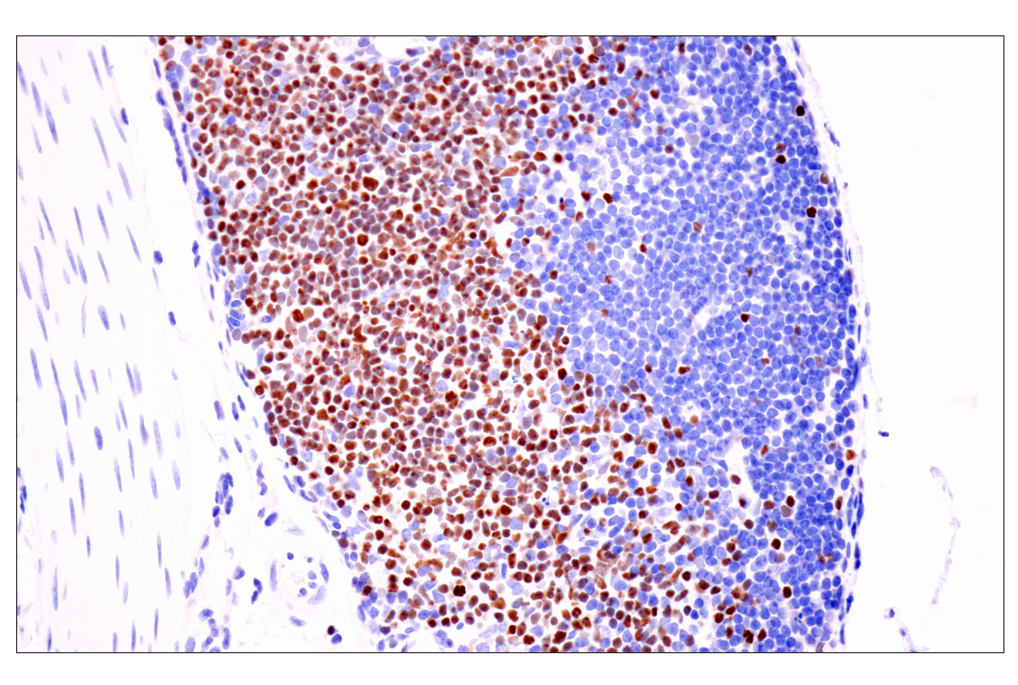 Immunohistochemistry Image 13: TCF1/TCF7 (E6O1K) Rabbit mAb