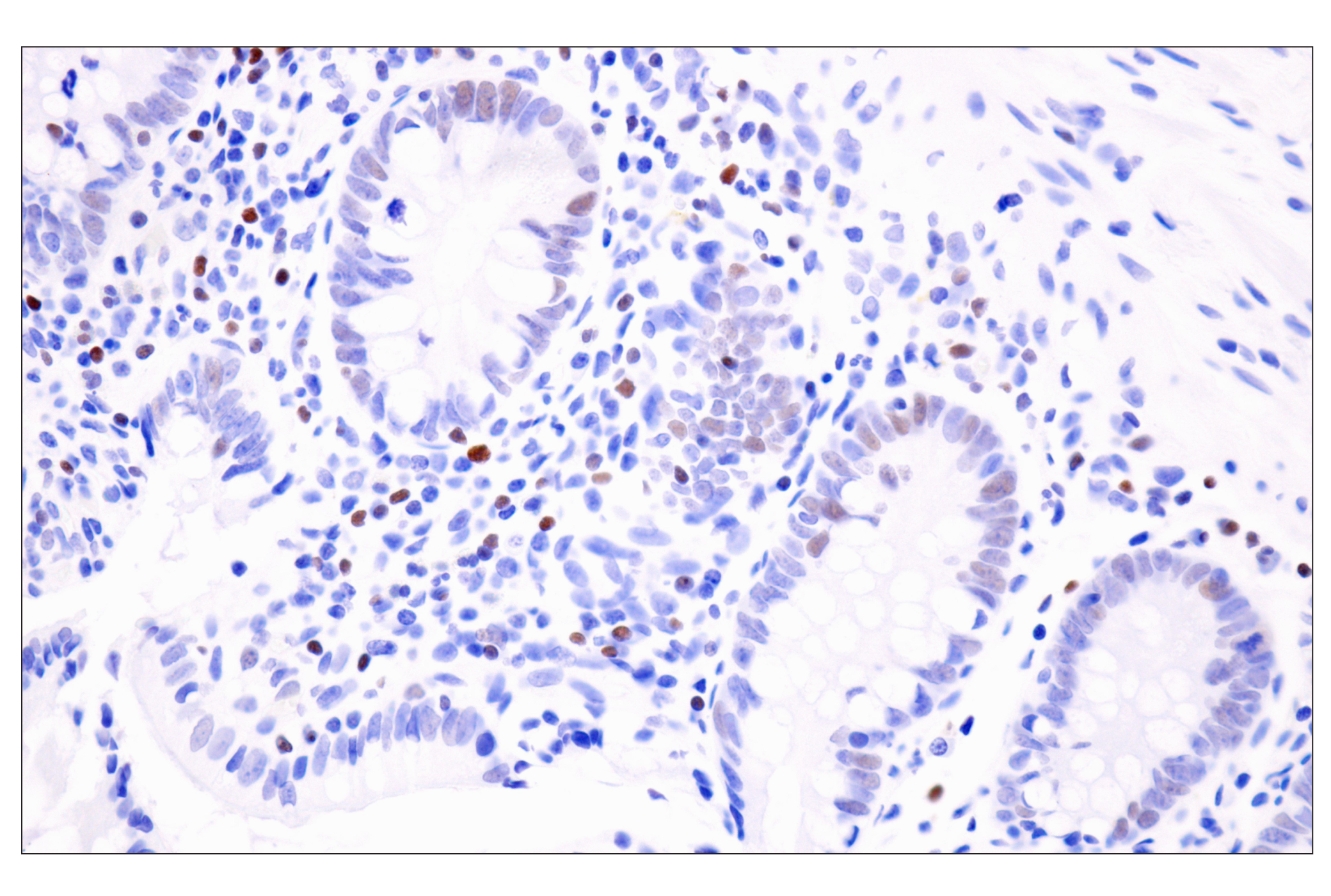 Immunohistochemistry Image 7: TCF1/TCF7 (E6O1K) Rabbit mAb