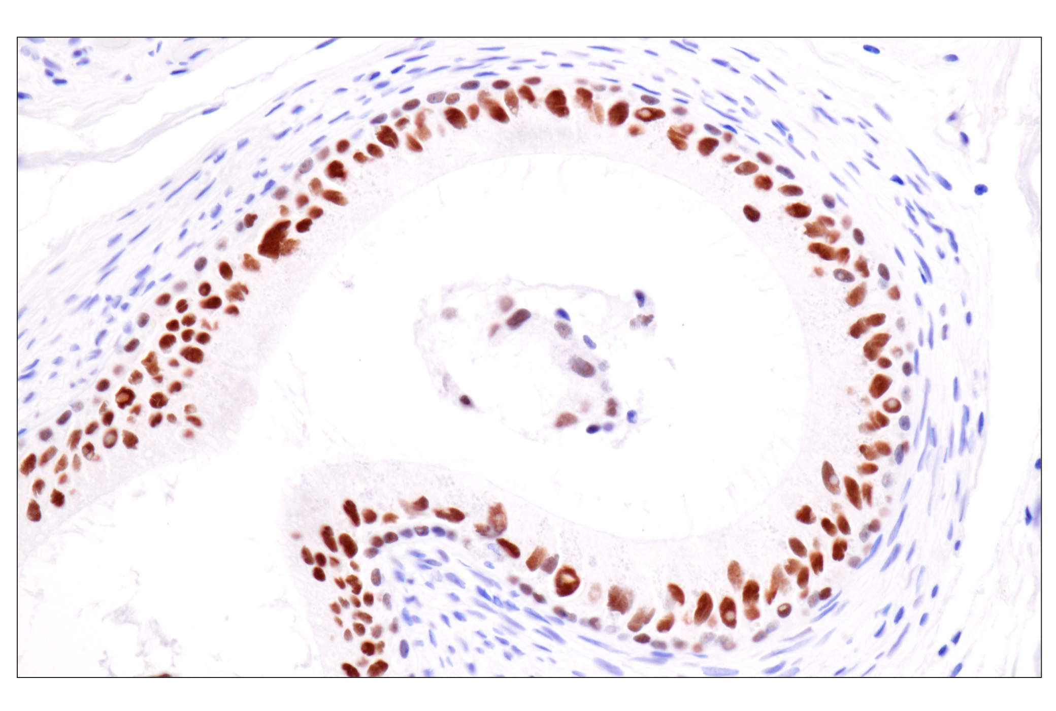 Immunohistochemistry Image 8: TCF1/TCF7 (E6O1K) Rabbit mAb