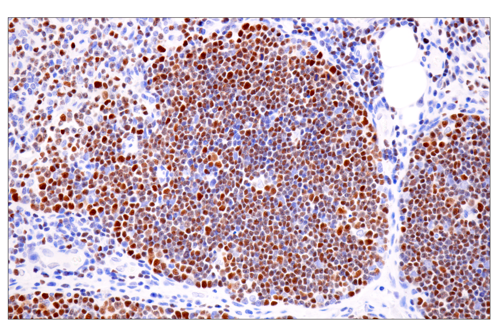 Immunohistochemistry Image 6: TCF1/TCF7 (E6O1K) Rabbit mAb