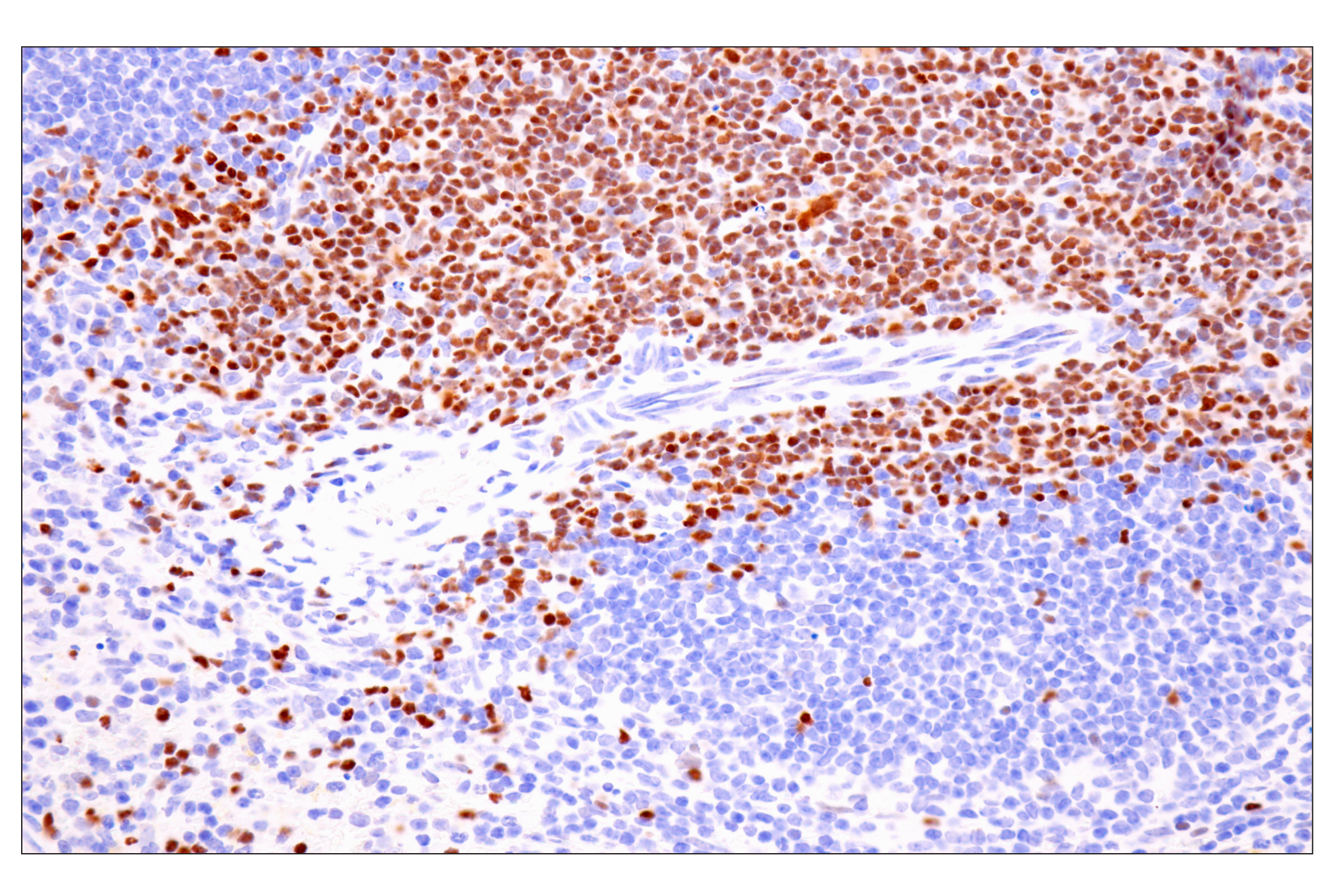 Immunohistochemistry Image 14: TCF1/TCF7 (E6O1K) Rabbit mAb