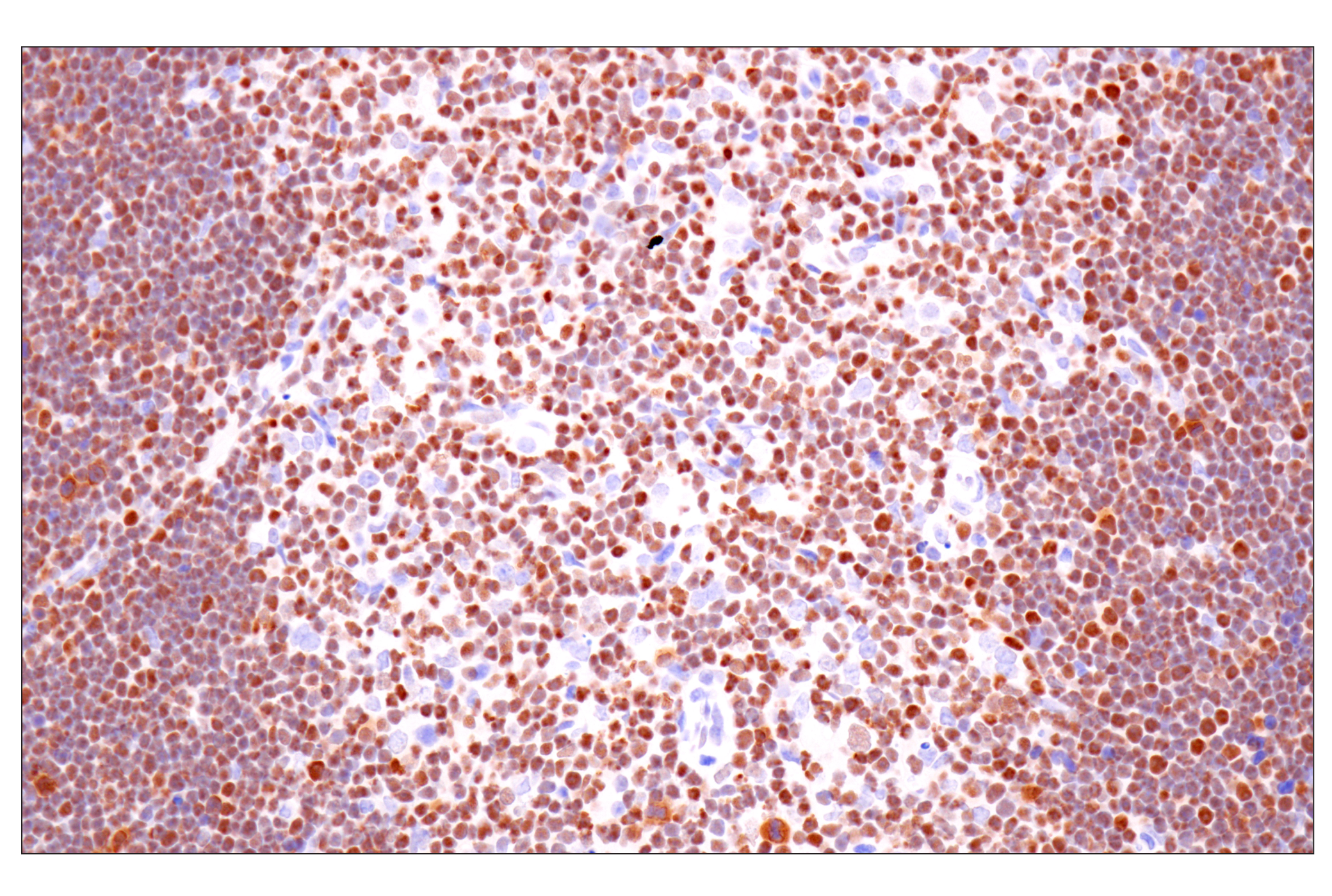 Immunohistochemistry Image 12: TCF1/TCF7 (E6O1K) Rabbit mAb