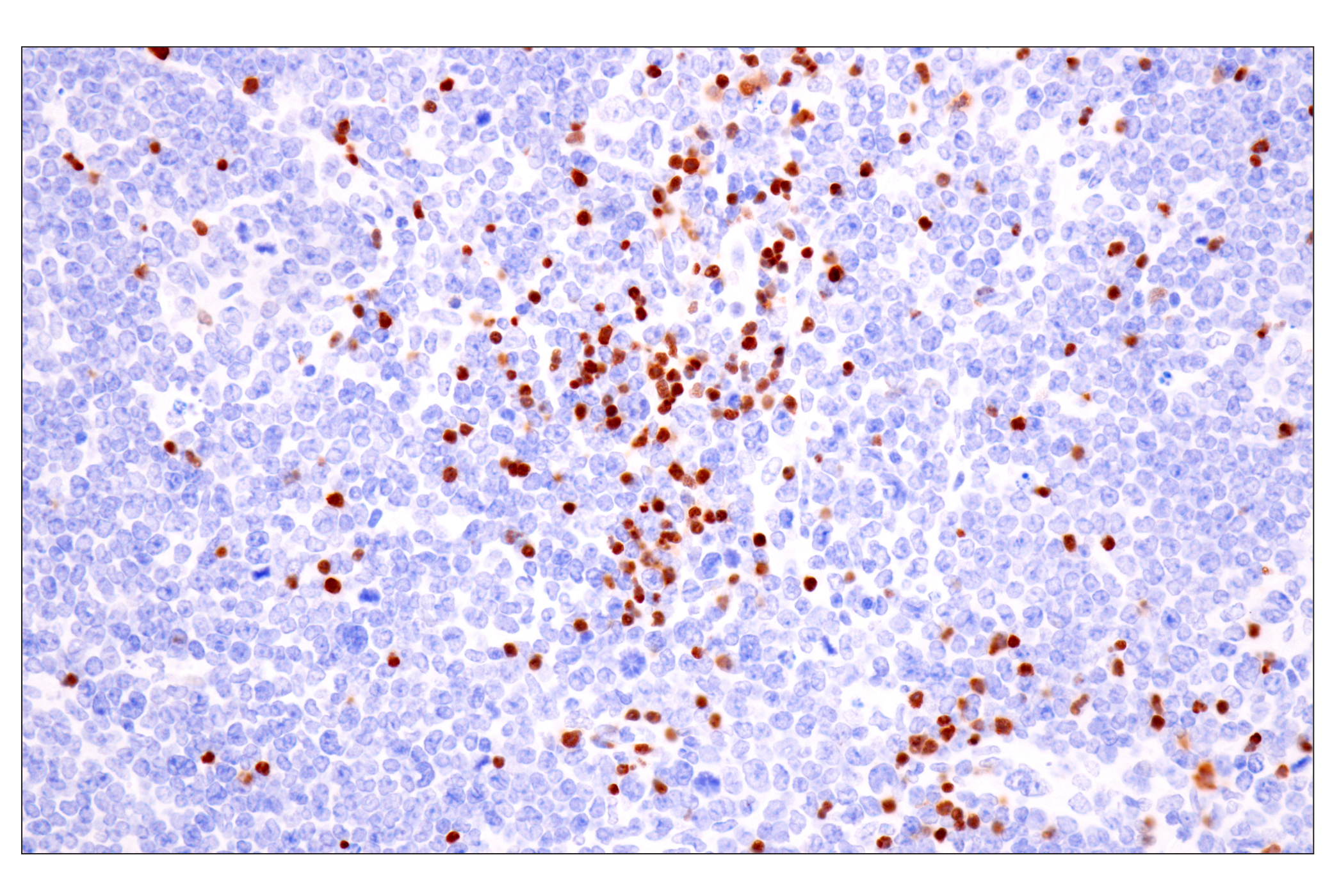 Immunohistochemistry Image 10: TCF1/TCF7 (E6O1K) Rabbit mAb