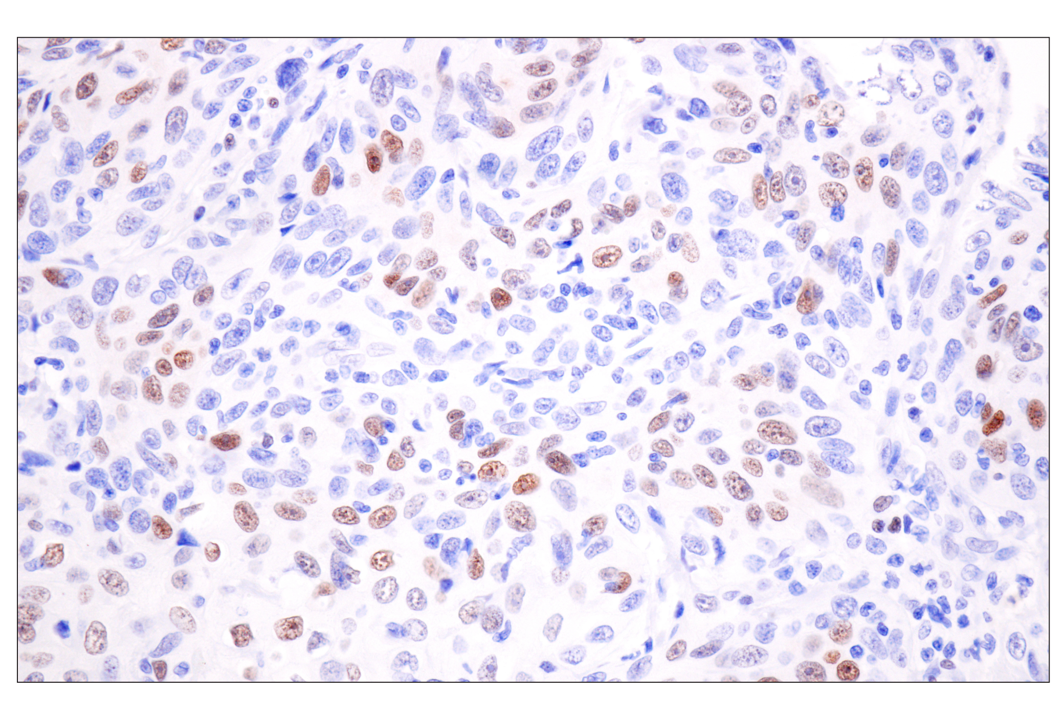 Immunohistochemistry Image 4: TCF1/TCF7 (E6O1K) Rabbit mAb