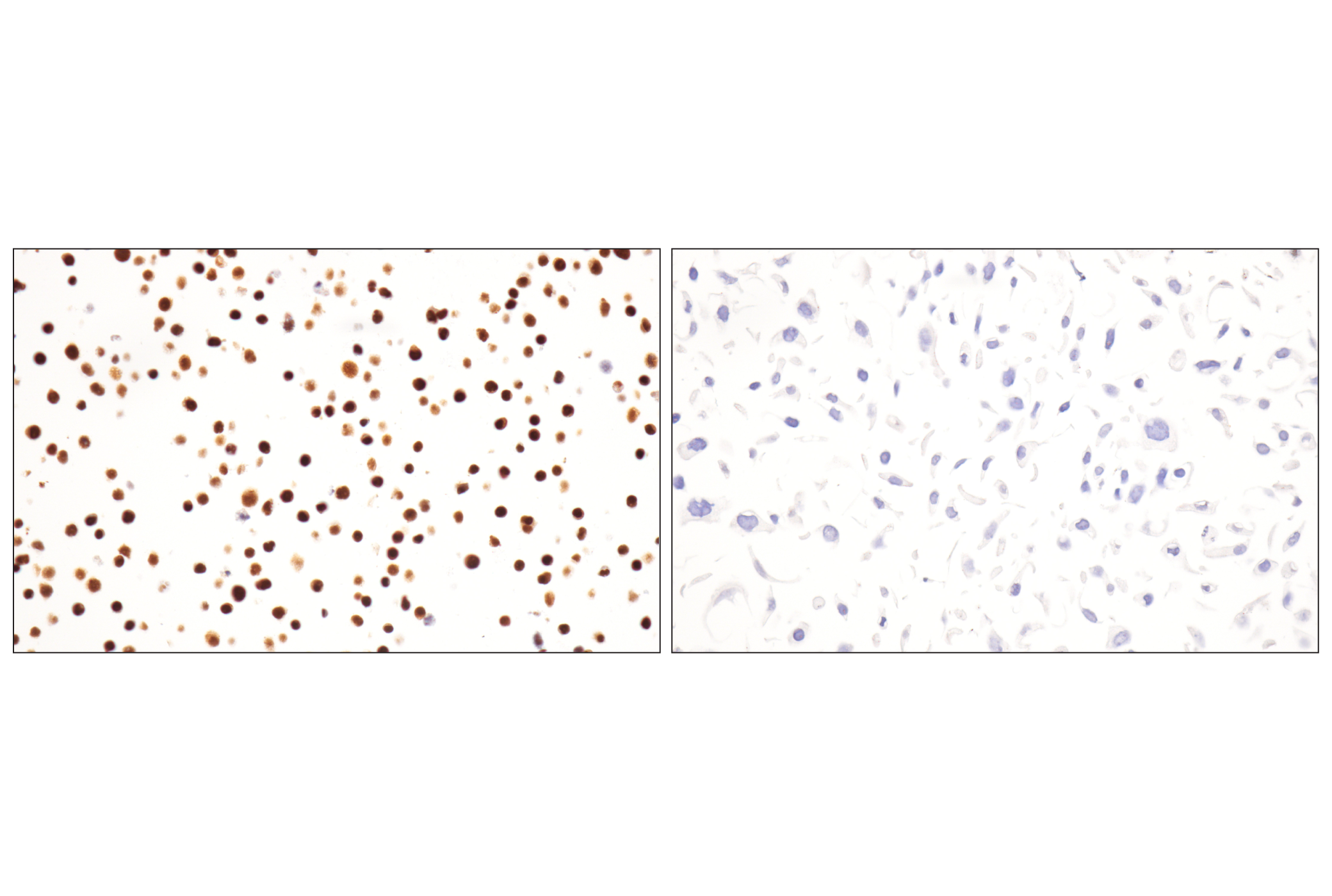 Immunohistochemistry Image 16: TCF1/TCF7 (E6O1K) Rabbit mAb