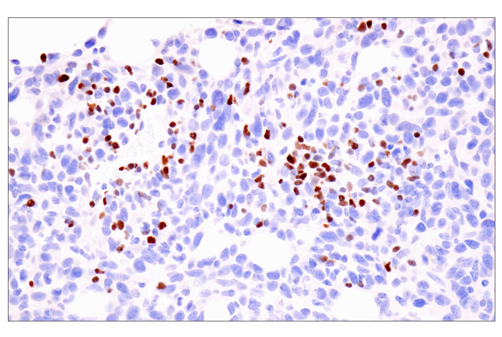 Immunohistochemistry Image 9: TCF1/TCF7 (E6O1K) Rabbit mAb