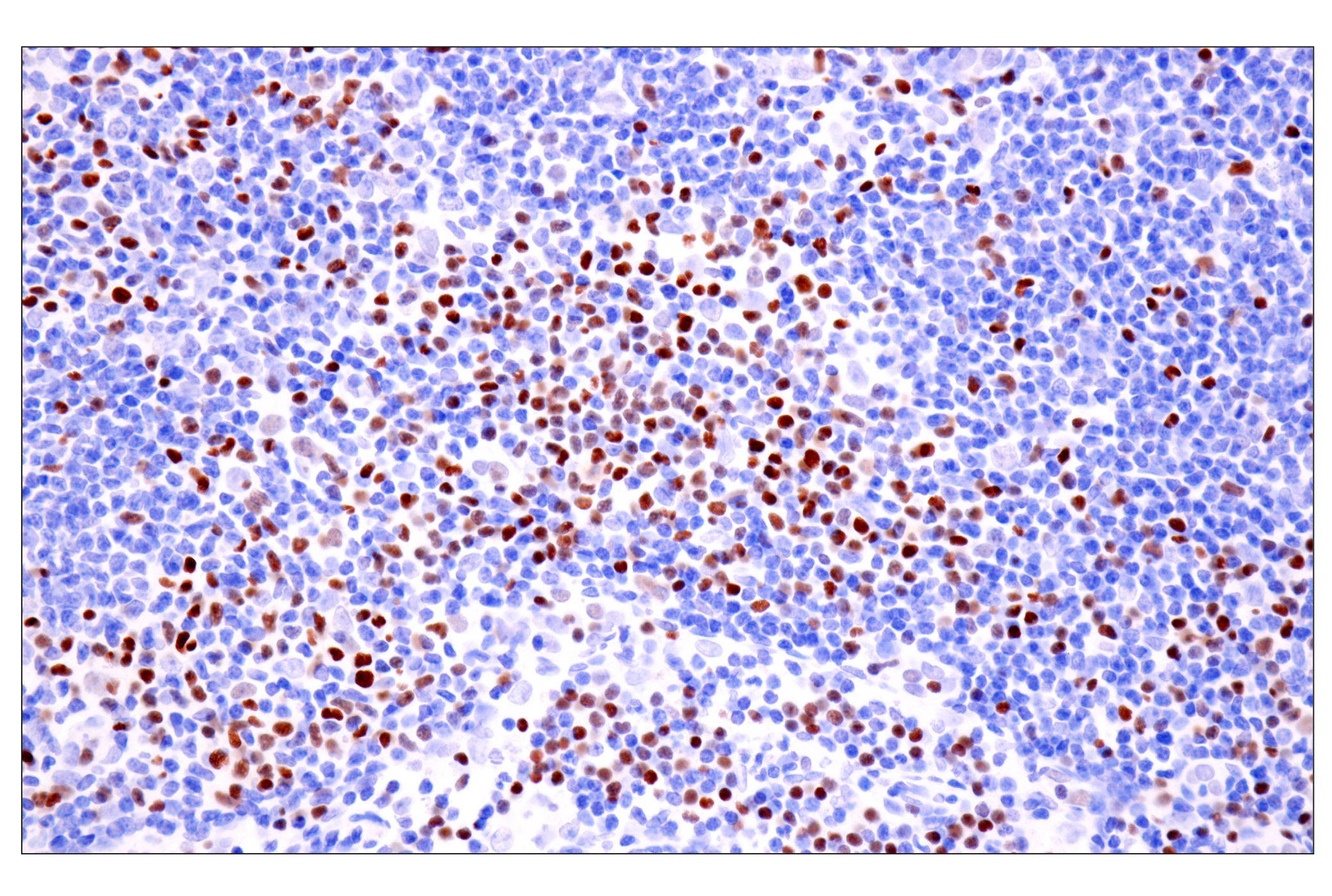 Immunohistochemistry Image 1: TCF1/TCF7 (E6O1K) Rabbit mAb