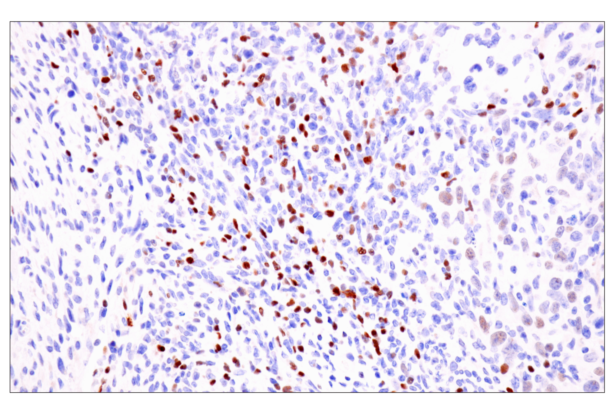 Immunohistochemistry Image 11: TCF1/TCF7 (E6O1K) Rabbit mAb