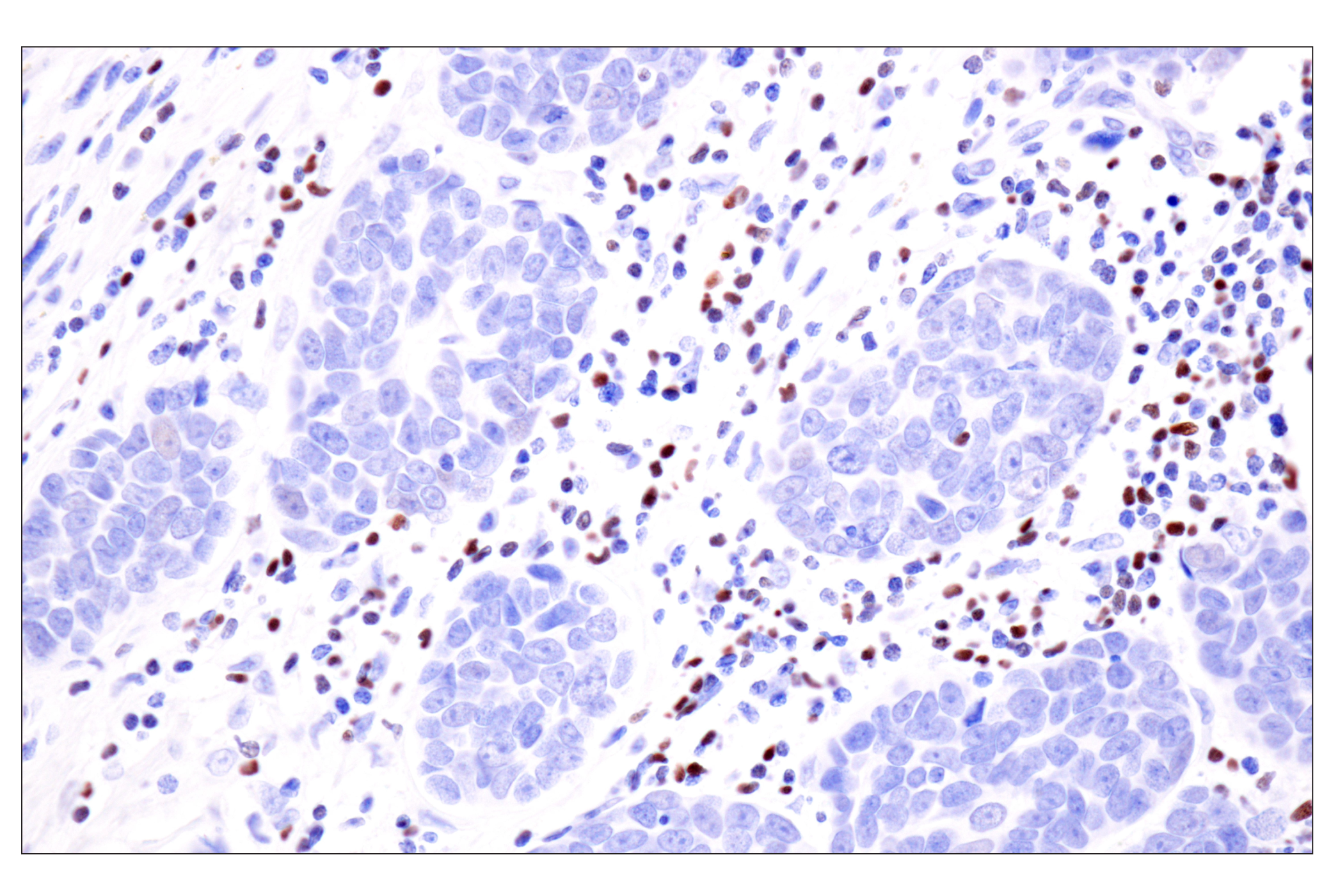 Immunohistochemistry Image 3: TCF1/TCF7 (E6O1K) Rabbit mAb