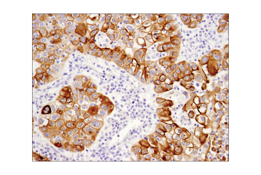 Immunohistochemistry Image 4: MUC1-C (D5K9I) XP® Rabbit mAb