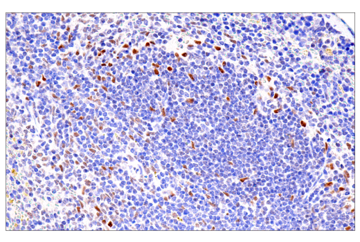 Immunohistochemistry Image 7: Bcl-3 (E4D4K) Rabbit mAb