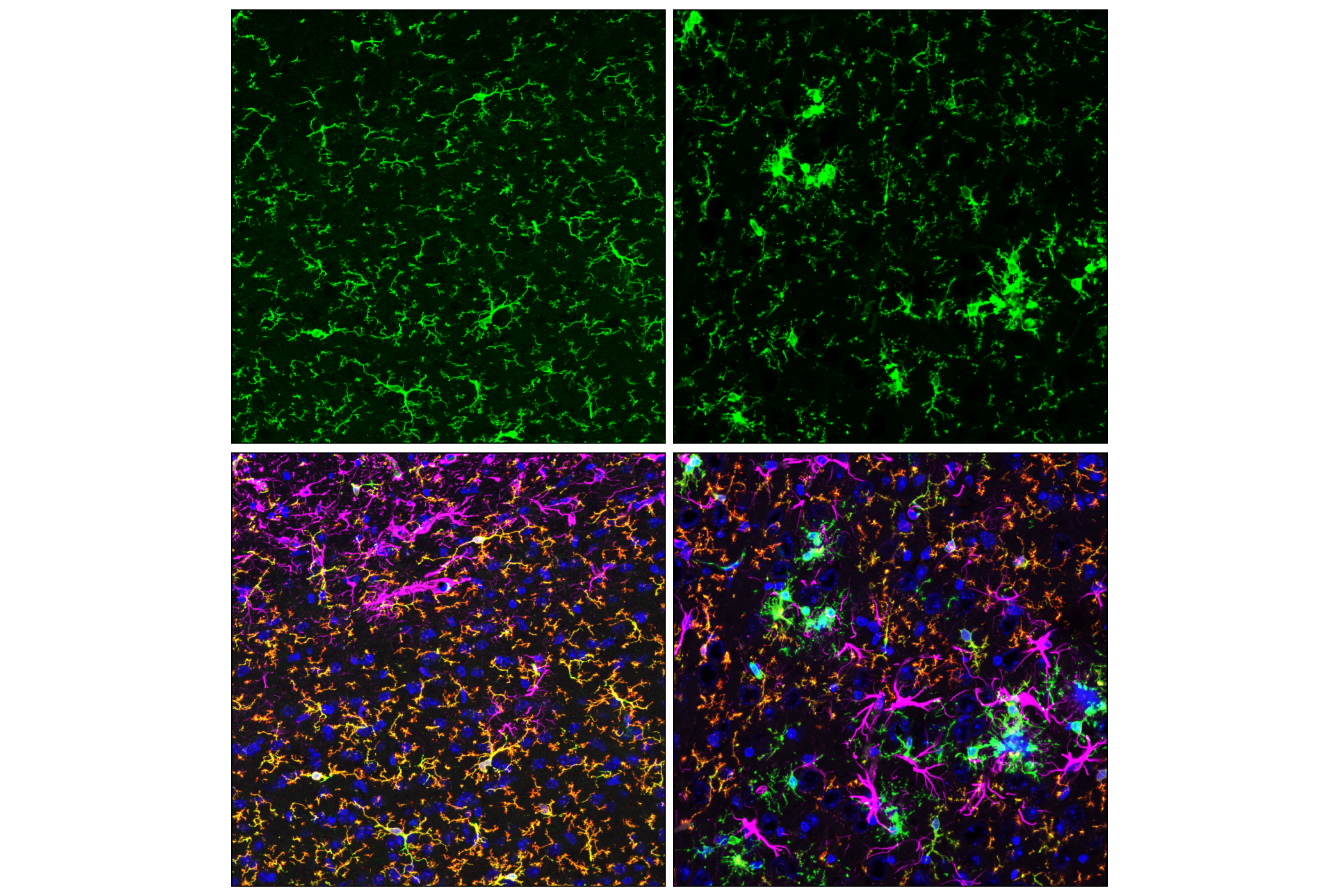 Immunofluorescence Image 1: HS1 (E6G7M) Mouse mAb