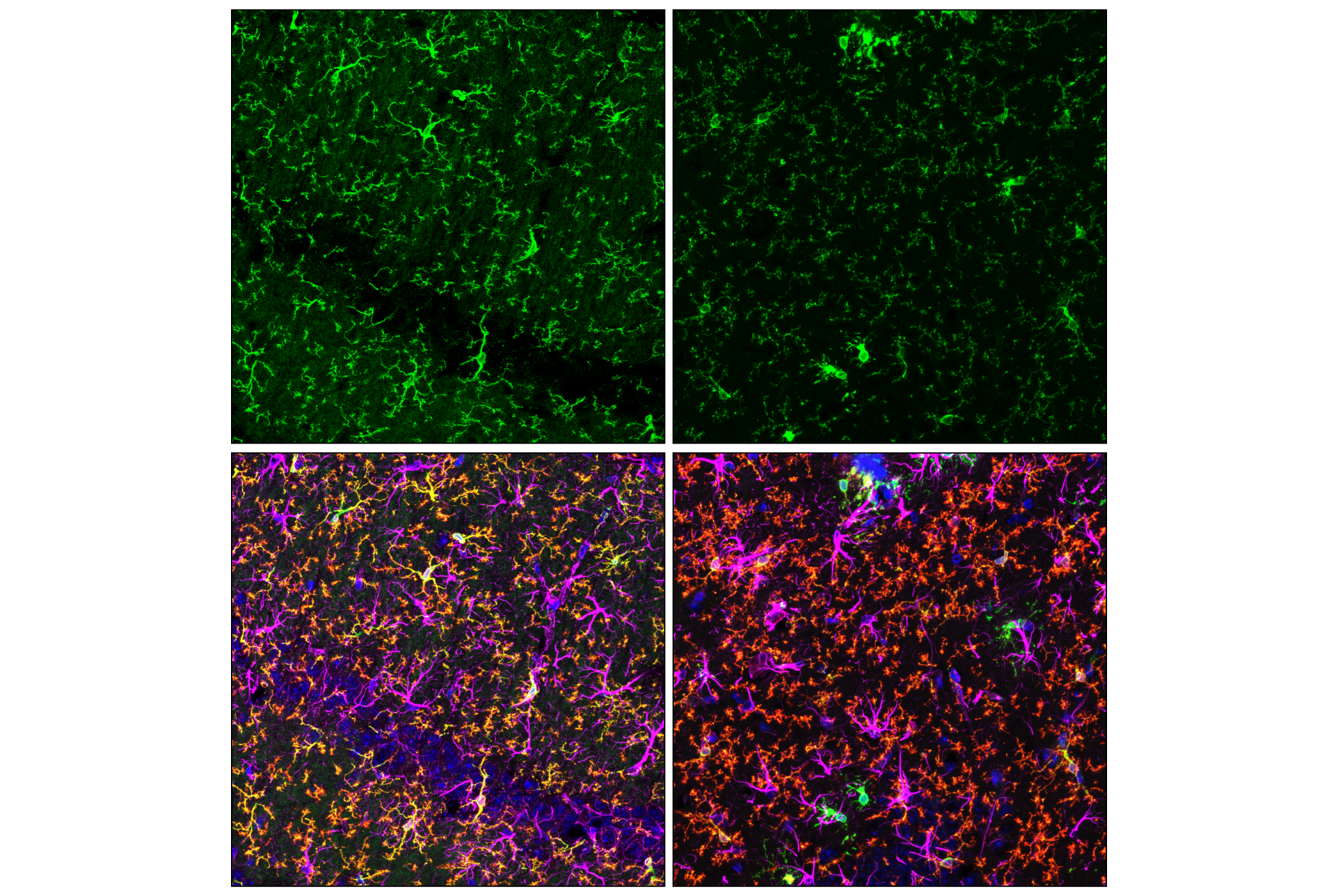 Immunofluorescence Image 2: HS1 (E6G7M) Mouse mAb