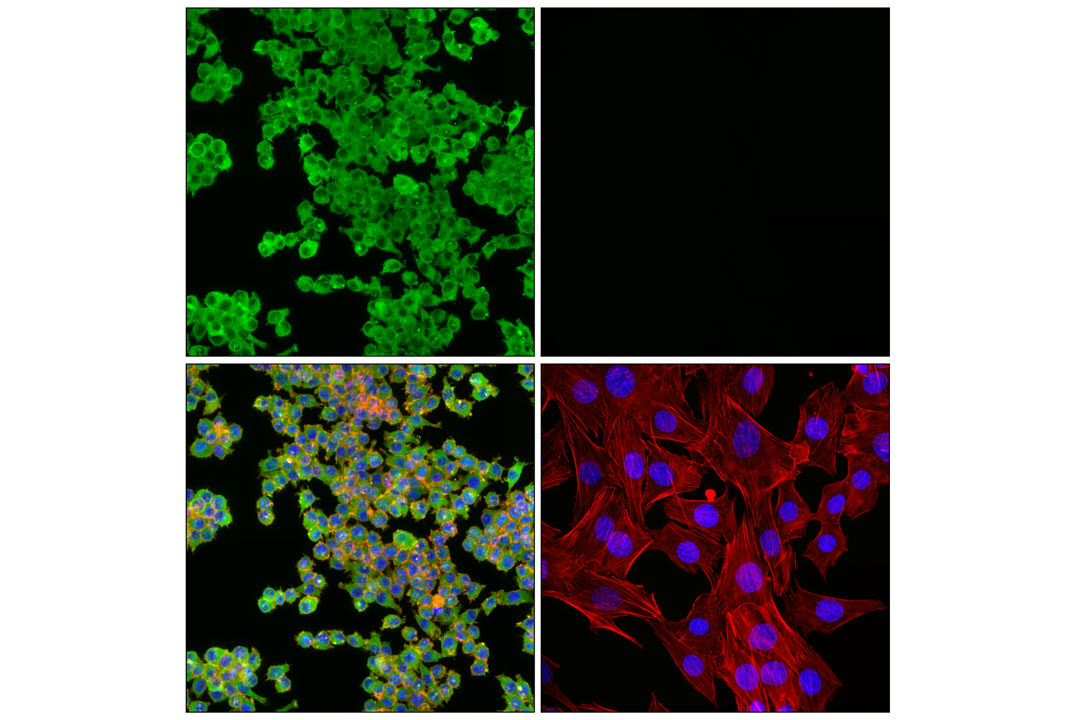 Immunofluorescence Image 3: HS1 (E6G7M) Mouse mAb