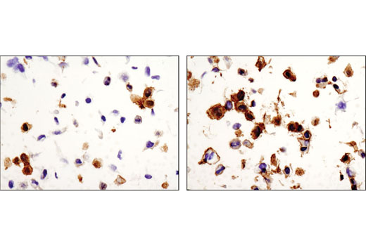 Immunohistochemistry Image 3: Phospho-EphA2 (Ser897) (D9A1) Rabbit mAb (BSA and Azide Free)