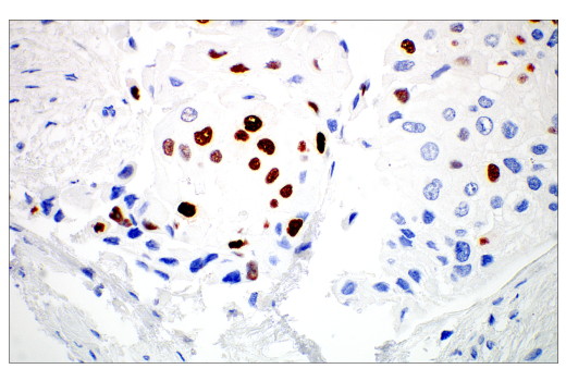 Immunohistochemistry Image 7: MAGE-C2/CT10 (E7B8D) XP® Rabbit mAb (BSA and Azide Free)