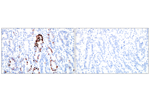 Immunohistochemistry Image 9: MAGE-C2/CT10 (E7B8D) XP® Rabbit mAb (BSA and Azide Free)