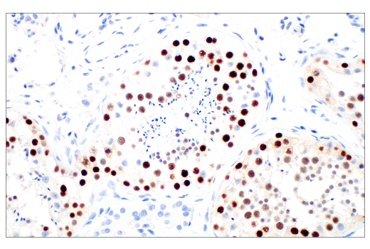 Immunohistochemistry Image 8: MAGE-C2/CT10 (E7B8D) XP® Rabbit mAb (BSA and Azide Free)