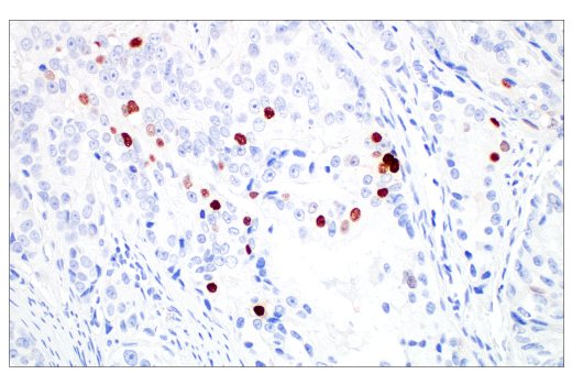 Immunohistochemistry Image 6: MAGE-C2/CT10 (E7B8D) XP® Rabbit mAb (BSA and Azide Free)