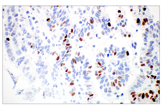 Immunohistochemistry Image 5: MAGE-C2/CT10 (E7B8D) XP® Rabbit mAb (BSA and Azide Free)